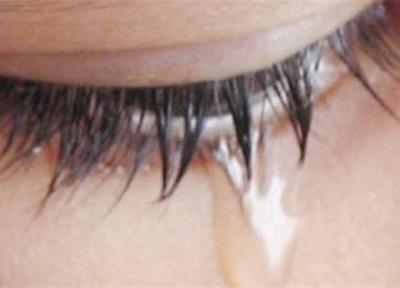 اشک خونین؛ نشانه یک بیماری مرگبار